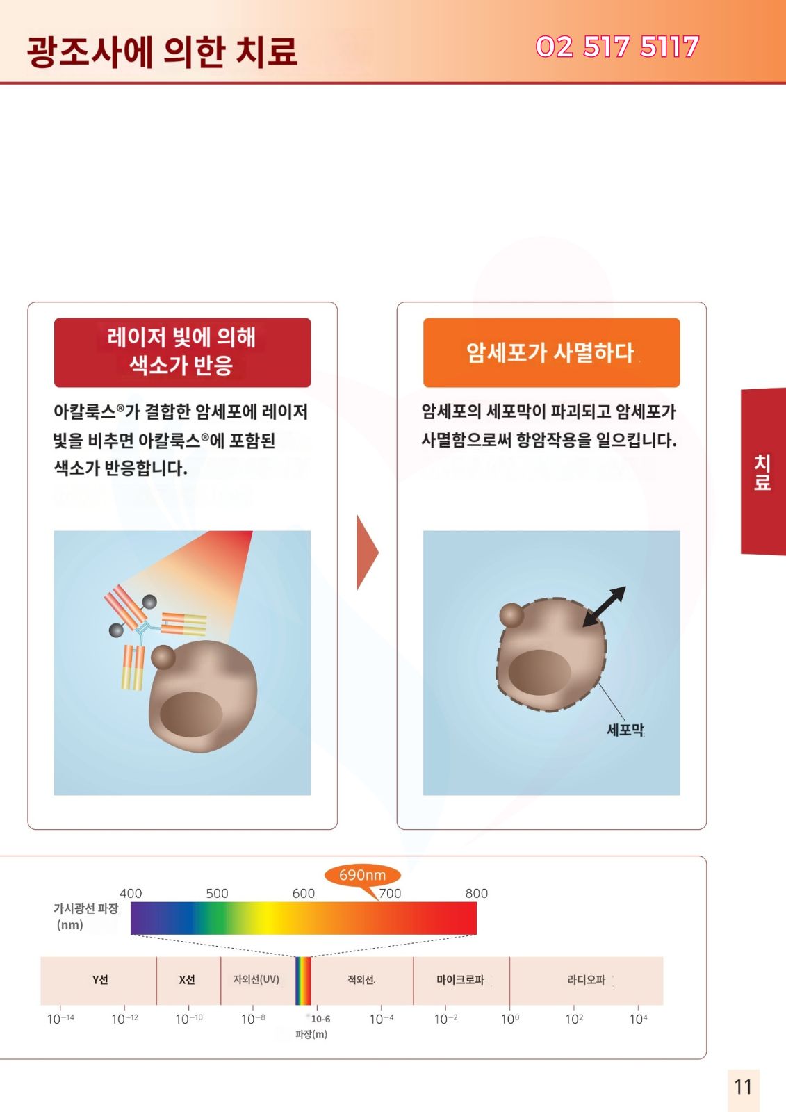 두경부암 광면역치료