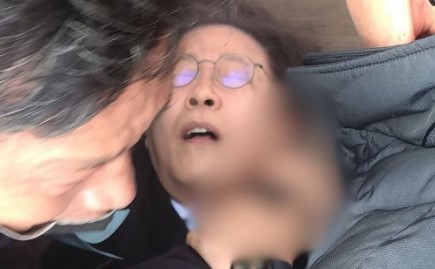 이재명 대표 부산 피습 경정맥 수술 상황