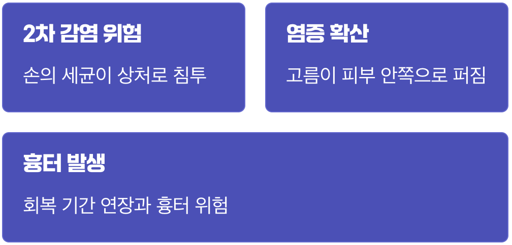 절대 짜면 안 되는 진짜 이유