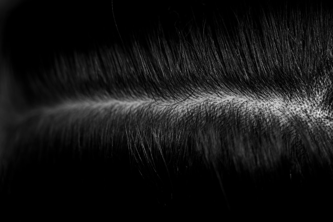 Scalp