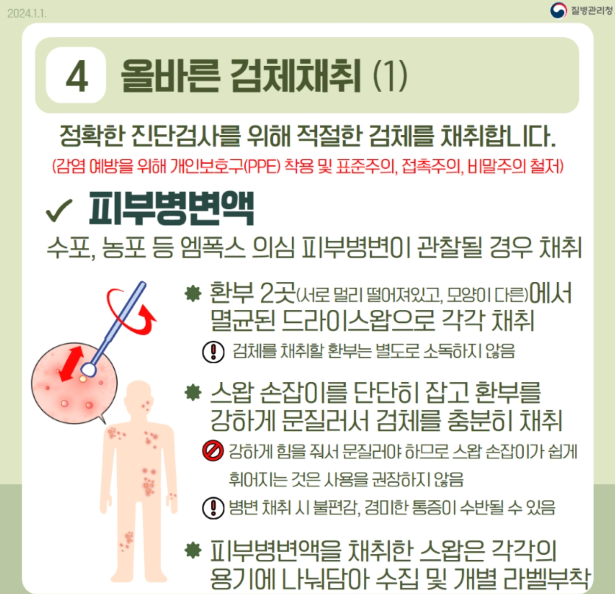 엠폭스 증상 감염경로
