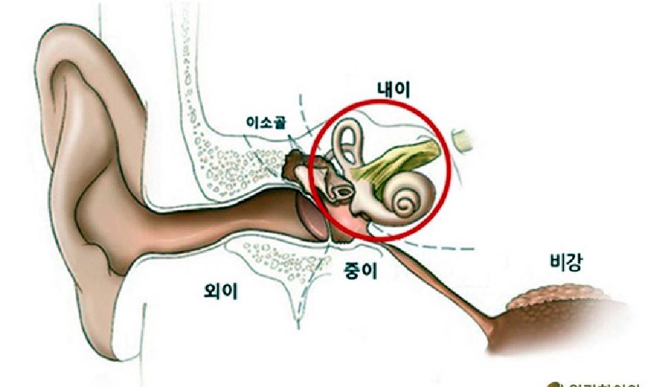 이석증 증상&amp;#44;원인&amp;#44;치료방법