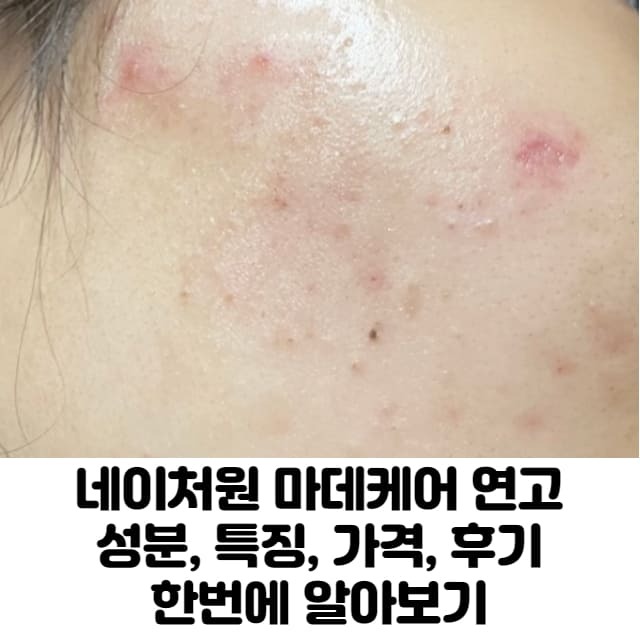 네이처원 마데케어 연고 네이처원 마데케어 연고