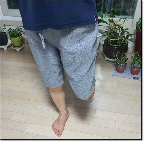 무지외반증 운동