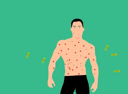 대상포진 예방접종 종류