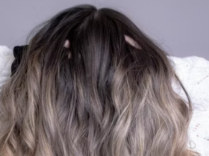 두피 가려움증 원인