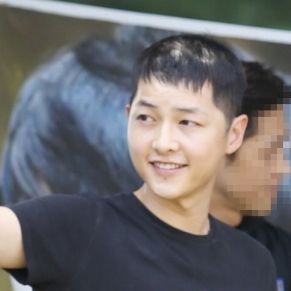 송중기 탈모