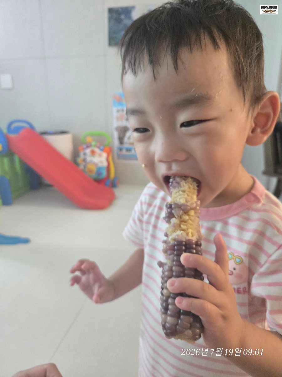 봉합 3개월 후 아기 이마 모습