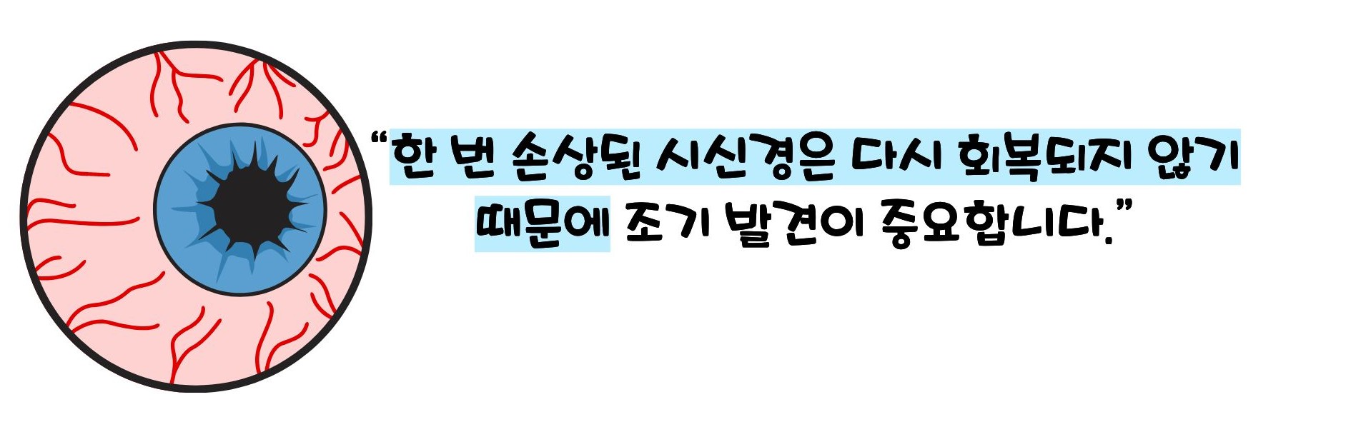 녹내장 초기증상