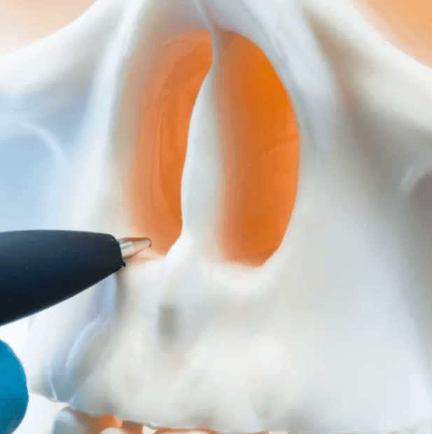 비중격만곡증-증상-치료-수술비용