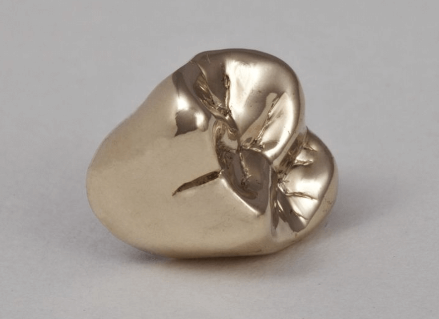 금니 판매 가격