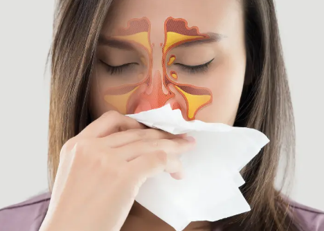 알레르기 비염 vs 축농증, 증상 차이와 치료법 비교