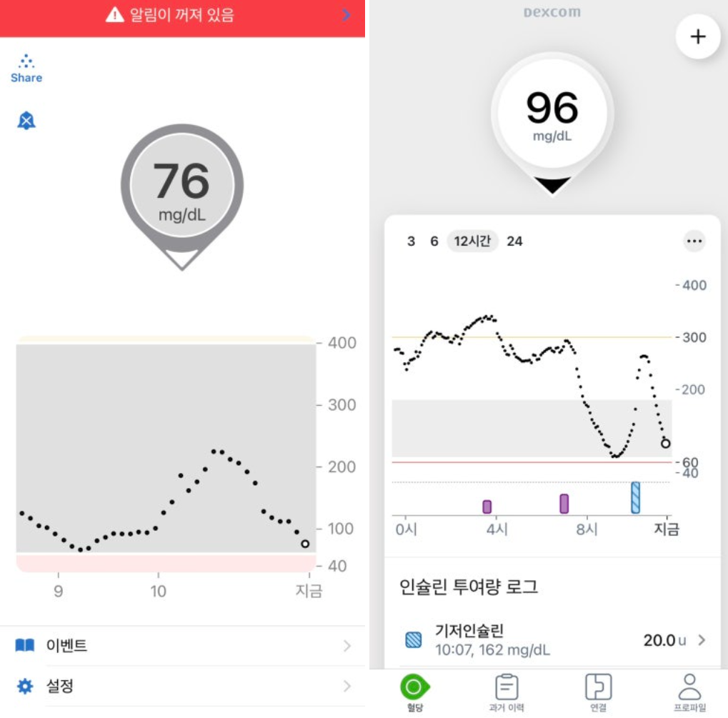 덱스콤 G7 효과