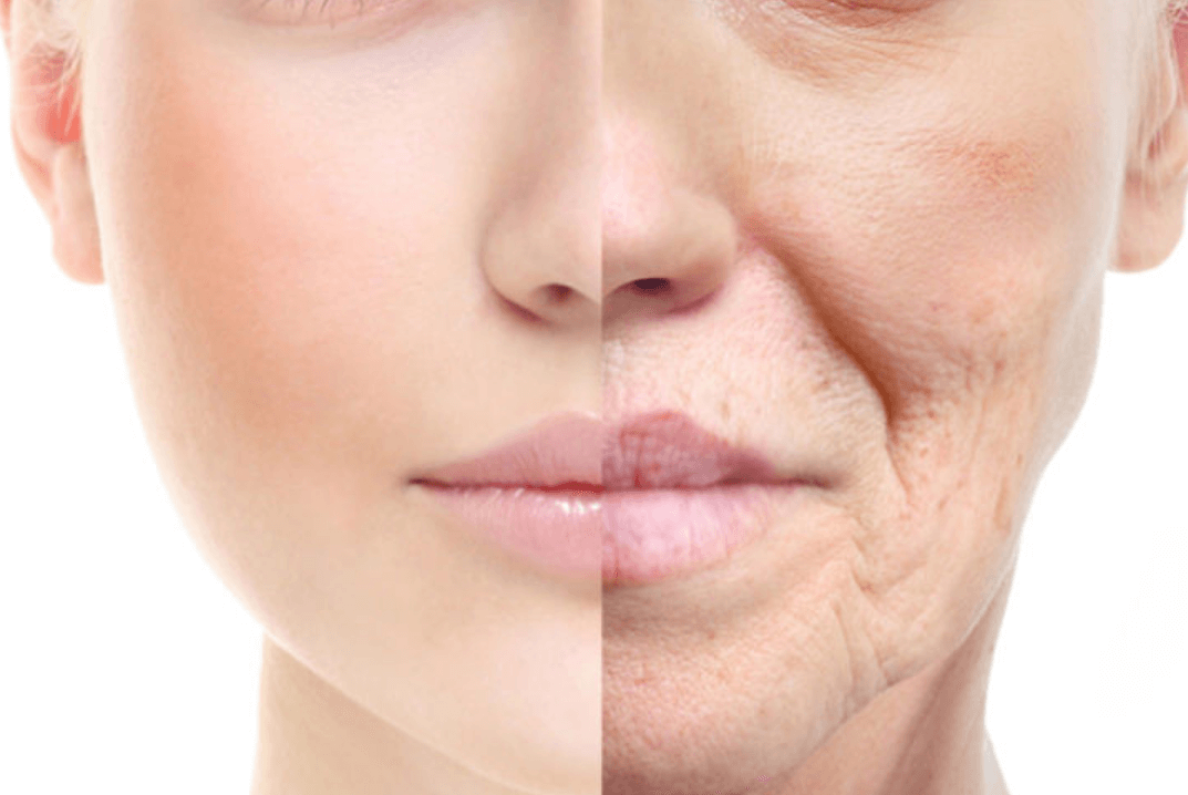 노화-피부-젊은-피부-대조-얼굴-사진