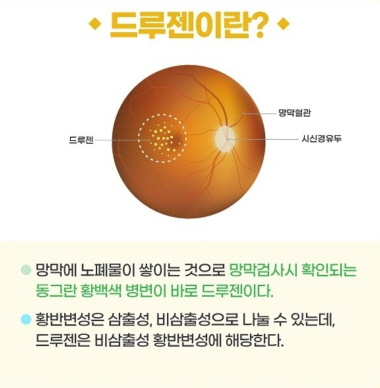 드루젠