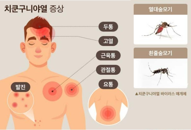 치쿤구니야열병
