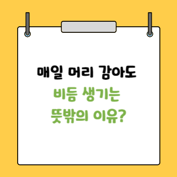비듬 생기는 이유와 해결법제시