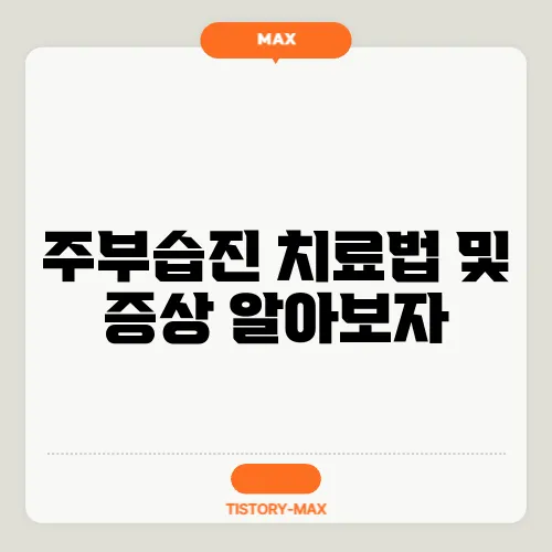 주부습진 치료법 및 증상 알아보자