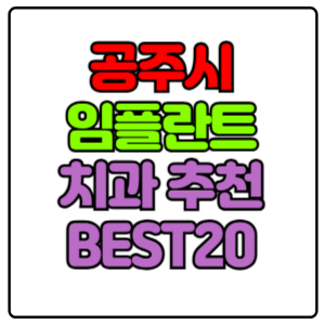 공주시 임플란트 치과 가격 비용 싼 곳,저렴한 곳,잘하는 곳,유명한 곳 BEST20 추천