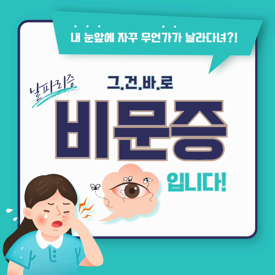 비문증이란 무엇인가? 원인, 연령대, 치료법, 좋은 음식까지 쉽게 알아보자!