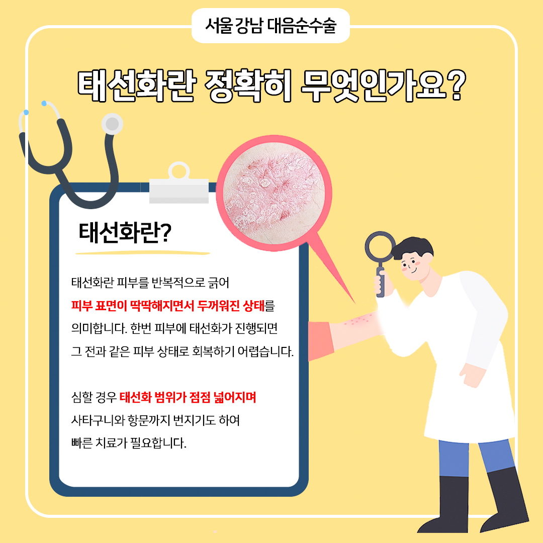 태선화란 뭔가요?