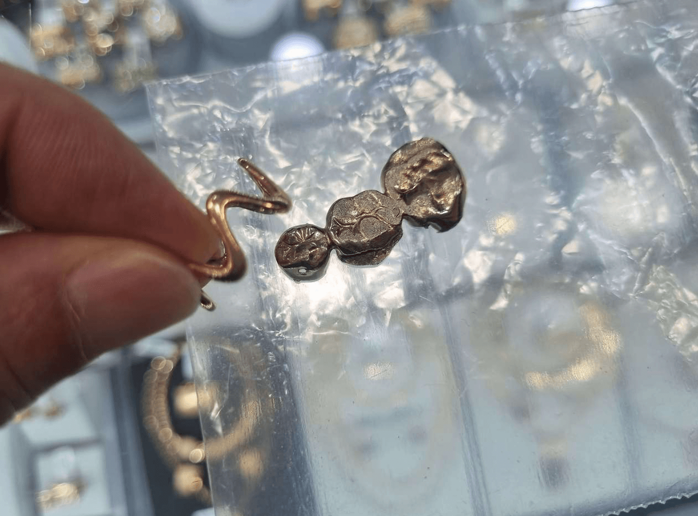 어금니 금니 가격