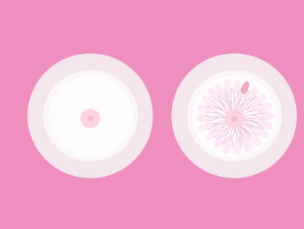 유방암 환자 마음치유법