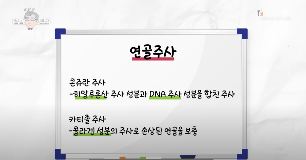 연골주사 - 콘쥬란, 카티졸 주사