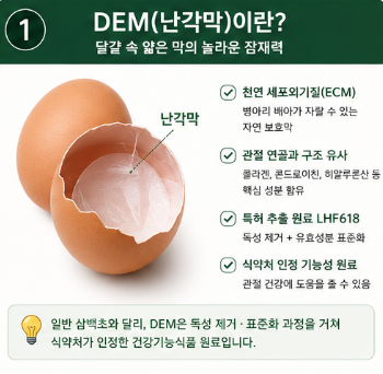 dem관절영양제-추천-효능-성분-효과-비교-가격