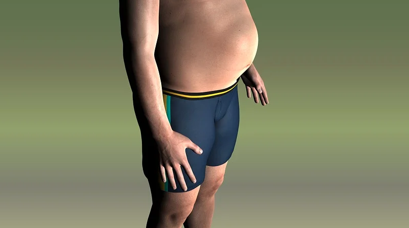 쿠싱증후군 : 관계없는 이미지