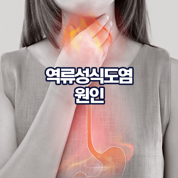 역류성식도염 원인