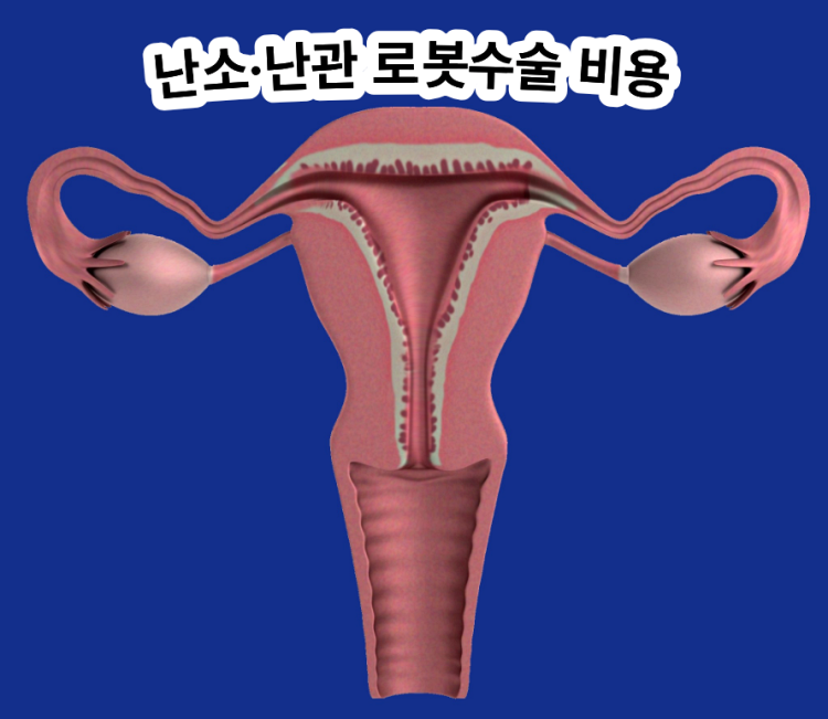 난소&middot;난관 로봇수술 비용