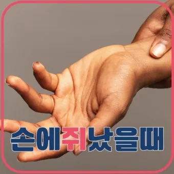 손에 쥐가 나는 이유와 해결 방법_19