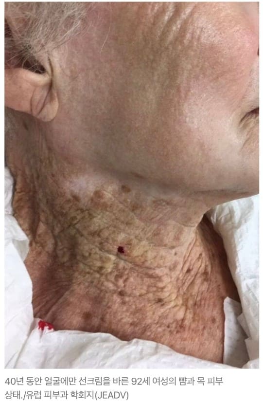 선크림의 중요성