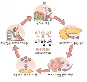 인슐린 저항성