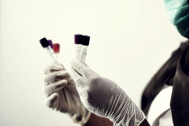 인벤티지랩 주가분석