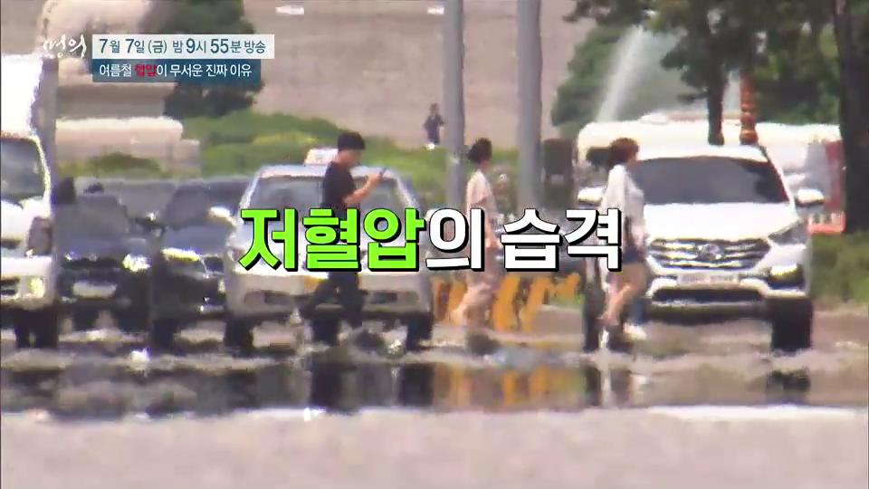 여름철 혈압이 무서운 진짜 이유, 기립성 저혈압, 미주신경성 실신, 고혈압 합병증, 뇌졸중 증상 치료 방법 이대부속병원 순환기내과 편욱범 교수 예약 추천