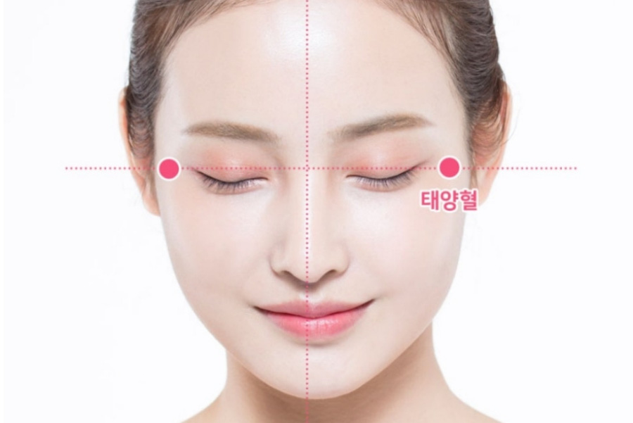 인체의 365혈 중에서 얼굴의 눈 양쪽 옆에 위치를 하고 있는 태양혈의 정확한 위치를 표시한 그림 사진