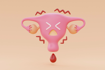 생리통-원인-이미지