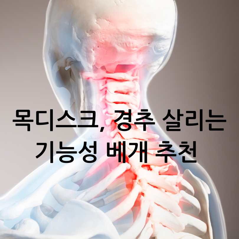 목디스크, 경추 살리는 기능성 베개 추천