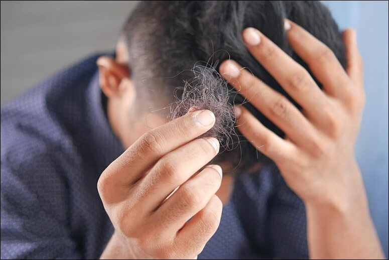 로게인폼 효과 사용법 가격