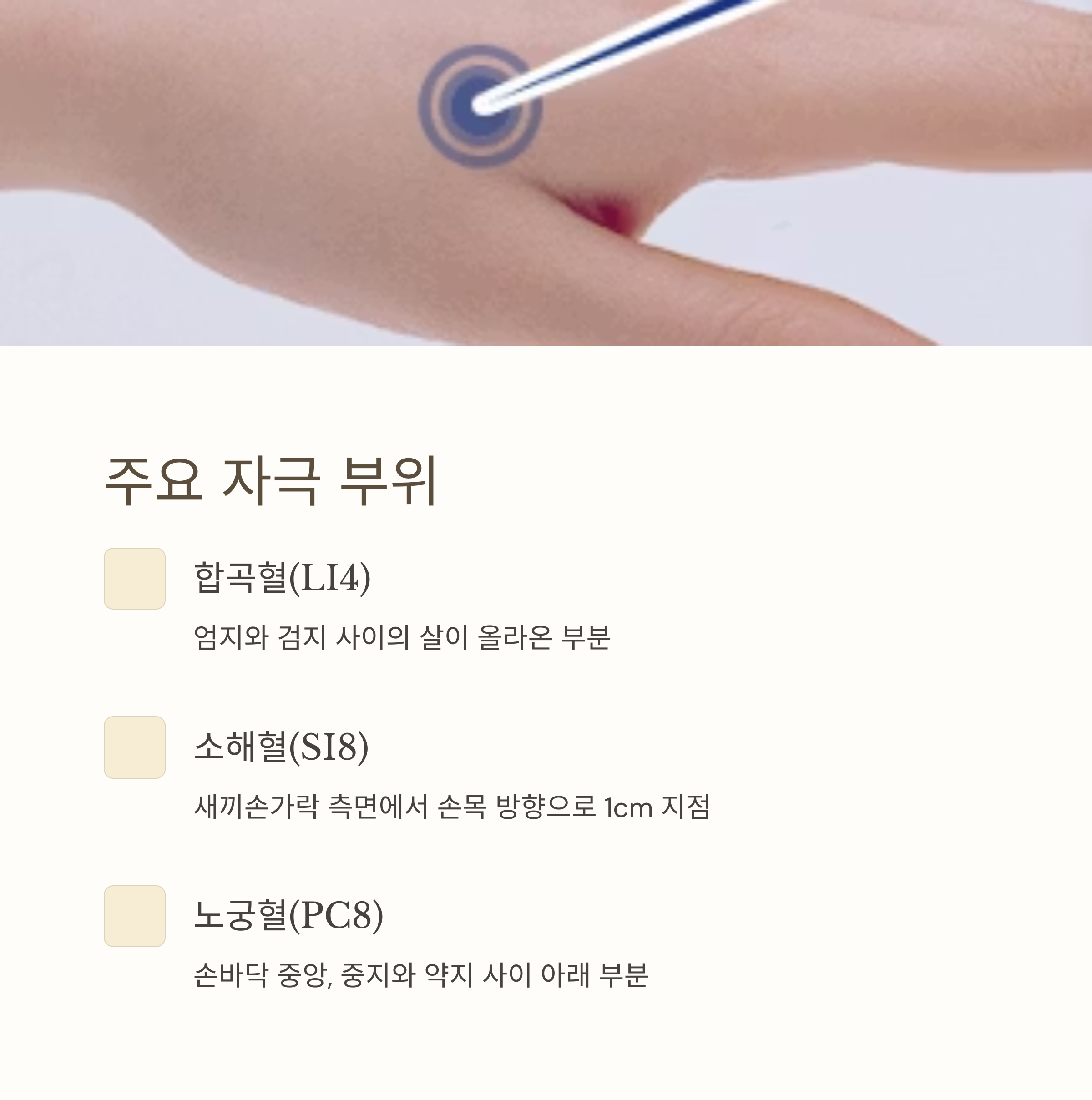 손발 저림에 수지침