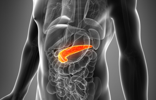 췌장암 초기 증상