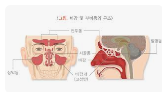 비염치료6