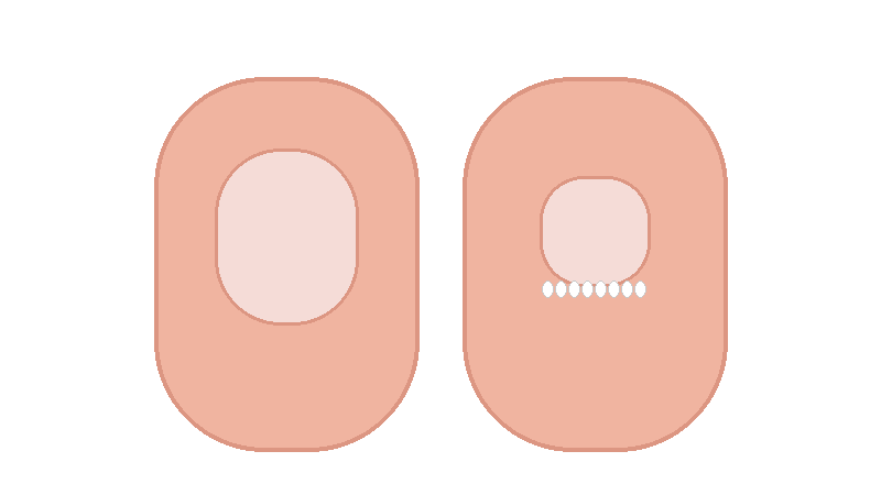 손톱 물어뜯기&middot;뜯기 습관(조갑박리증) 교정법: 손톱 망가지는 과정과 끊는 방법까지