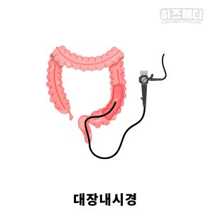 위저선 용종