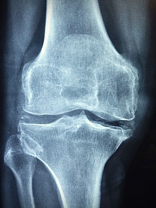 호관원 프리미엄 관절