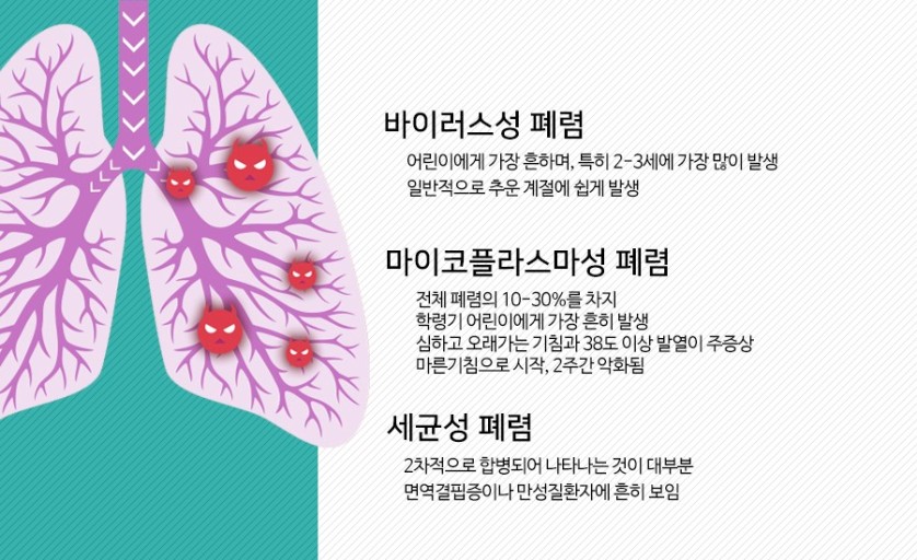 폐렴의 유형을 설명하는 이미지 입니다.