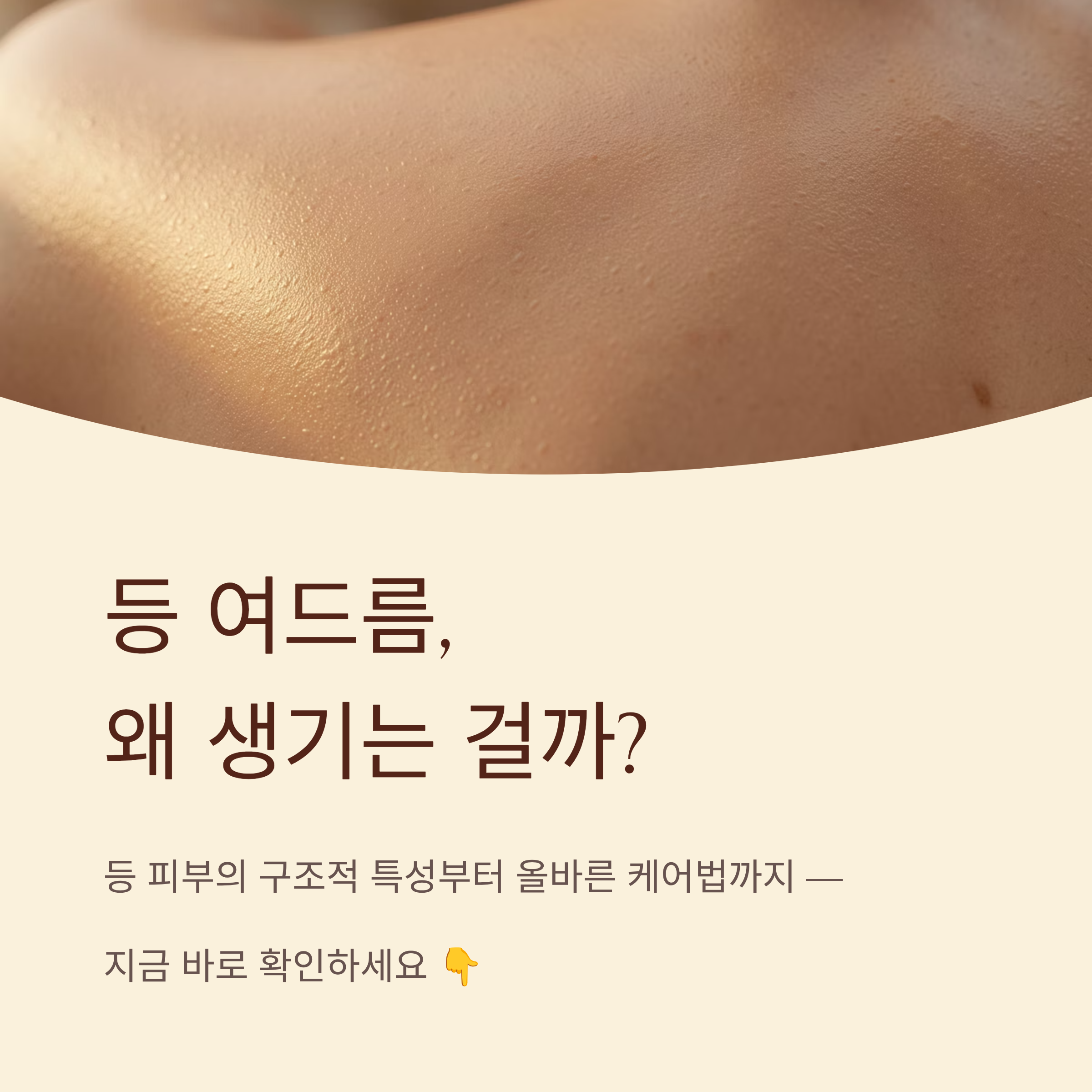 여드름 발생 원인