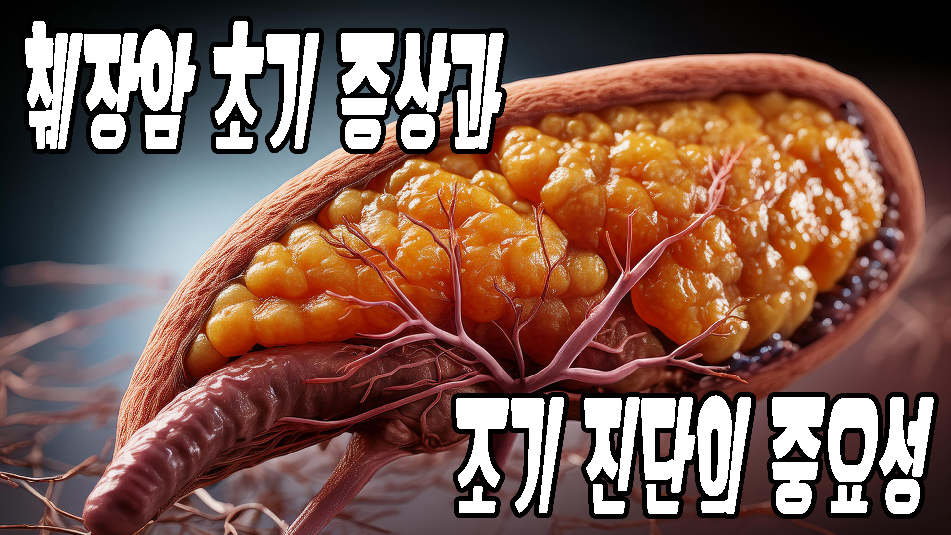 췌장암 초기 증상과 조기진단의 중요성